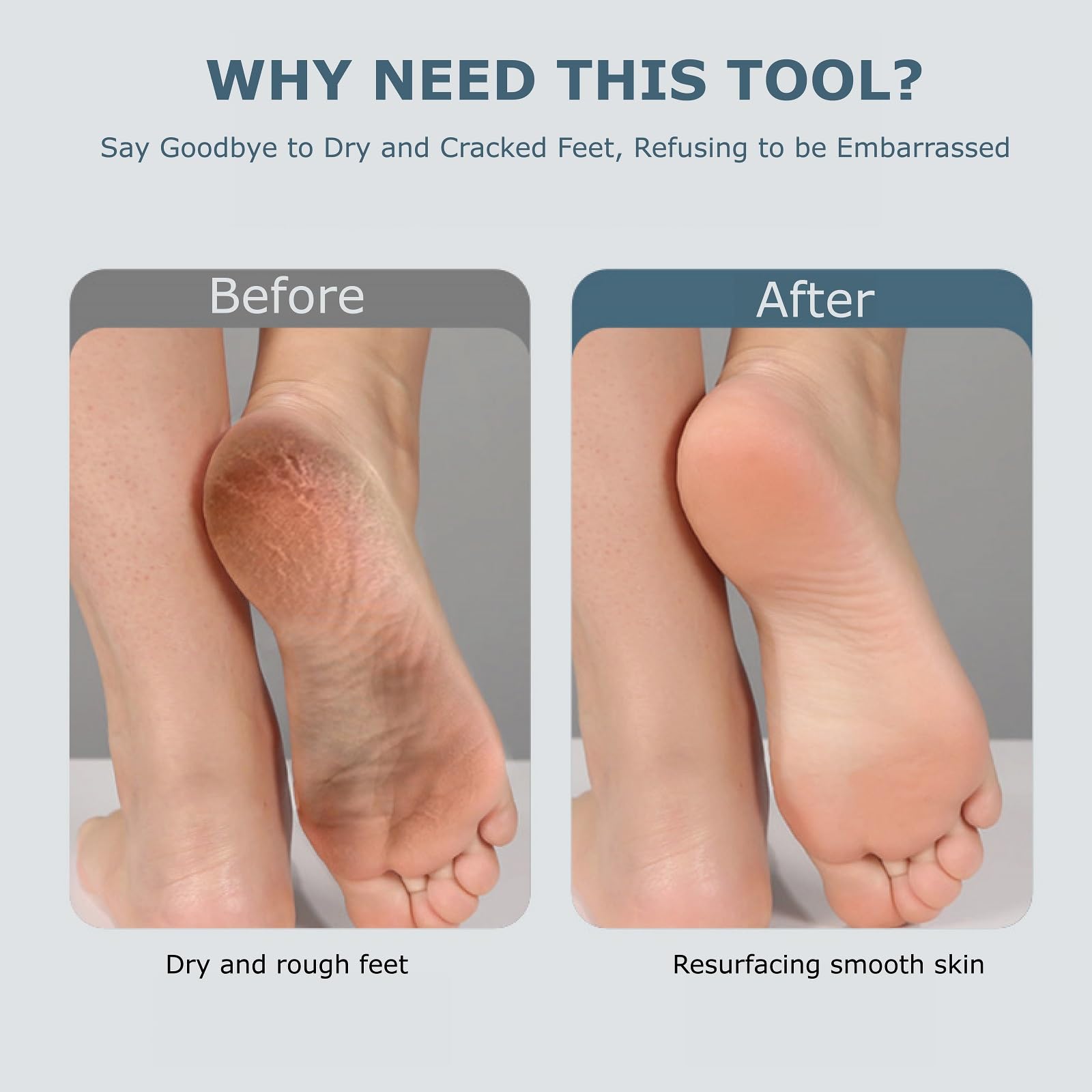 Fooseey eco-friendly materials foot file for safe skincare