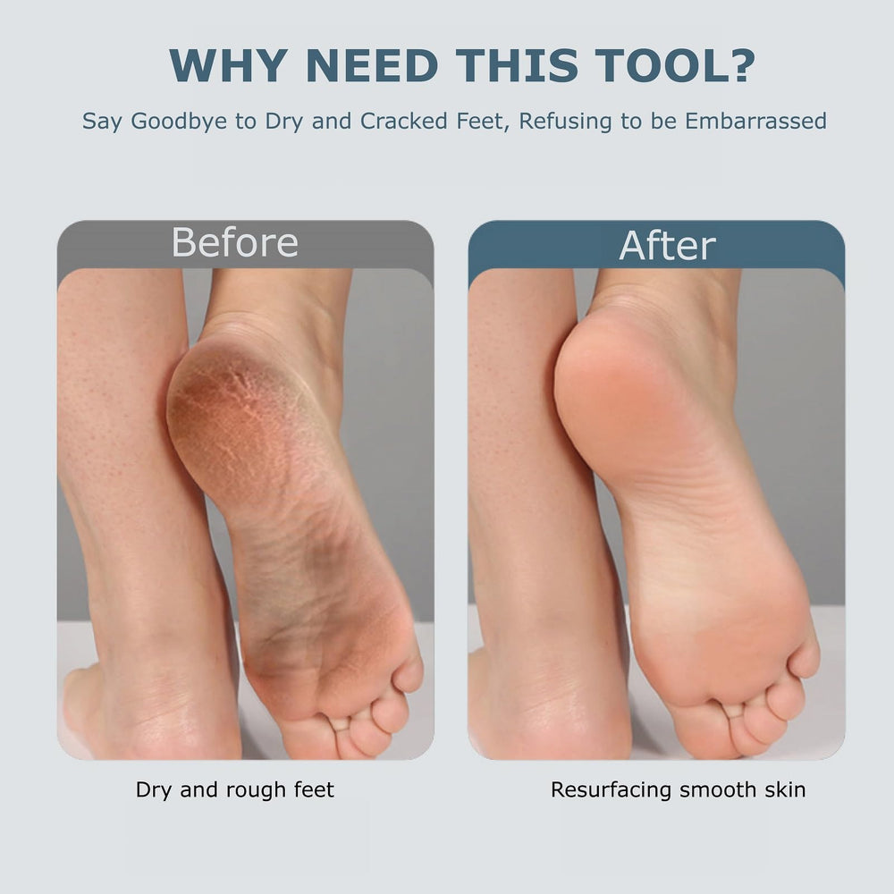 Fooseey eco-friendly materials foot file for safe skincare
