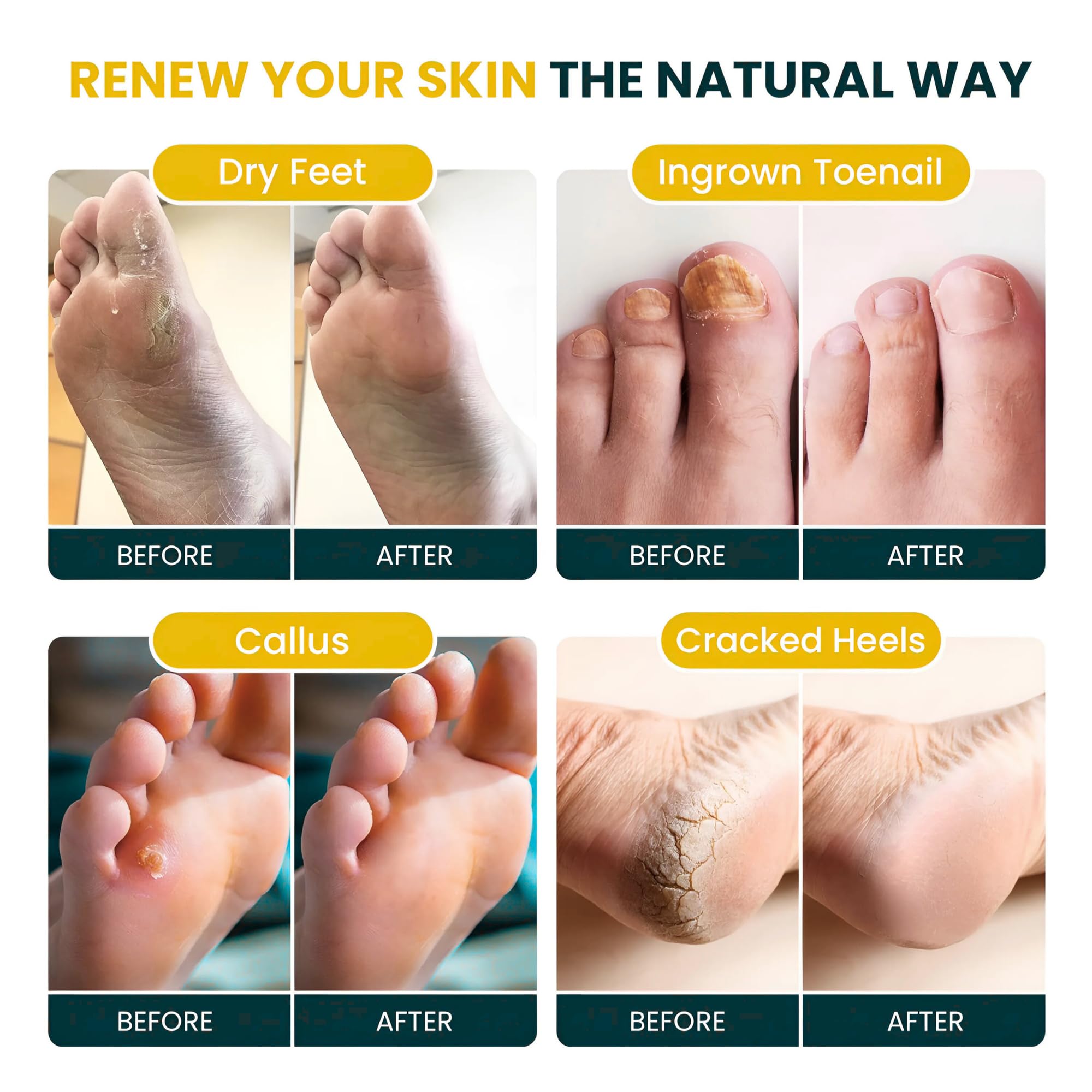 Foot Cure desintoxicacion: aroma cítrico para spa de pies en casa.