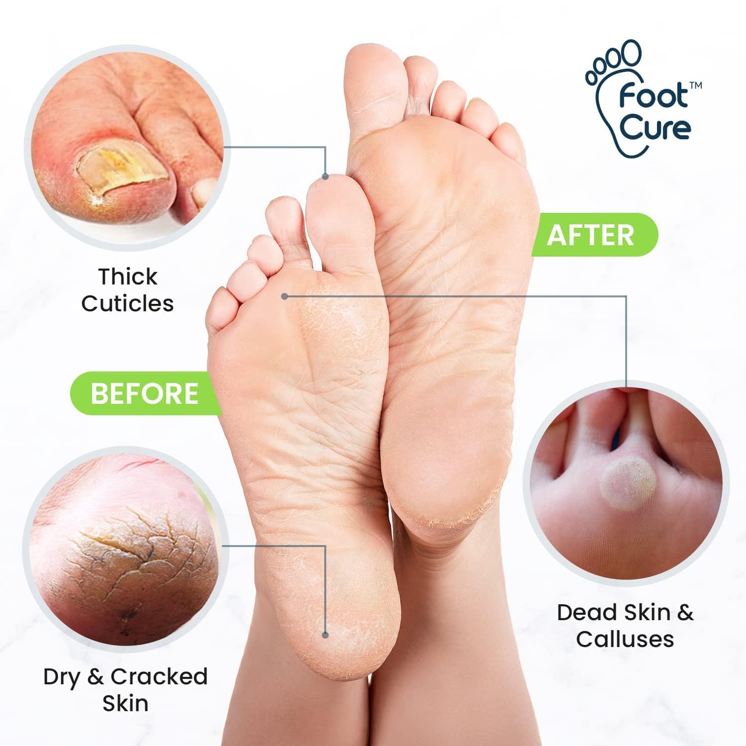 FOOT CURE Made in USA label indicating quality and safety