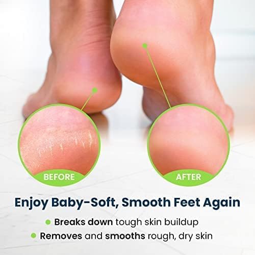 FOOT CURE Pedicure Set with four components for comprehensive foot care