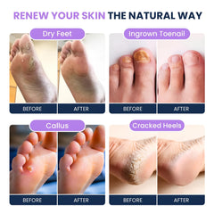 FOOT CURE raspador-pies, exfoliación suave para pies lisos.