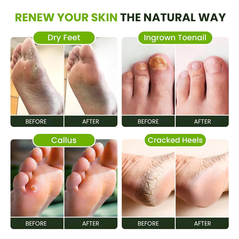 Foot Cure soft feet after use with silky-smooth look