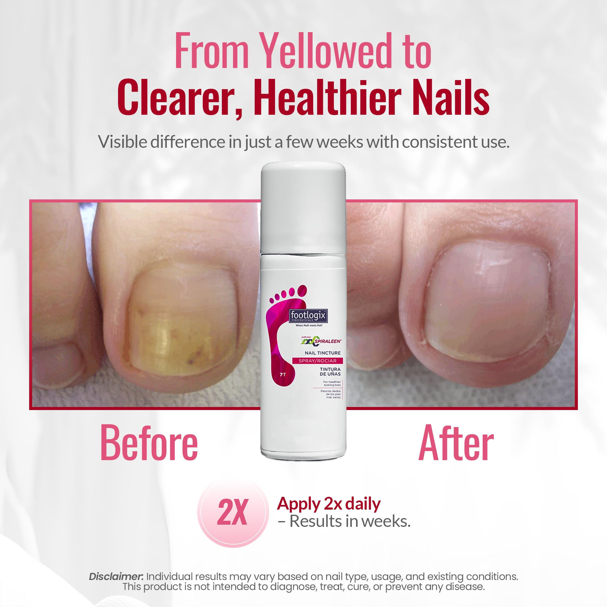 Footlogix Avocado Oil Panthenol nourishes nails for a smooth, resilient appearance.