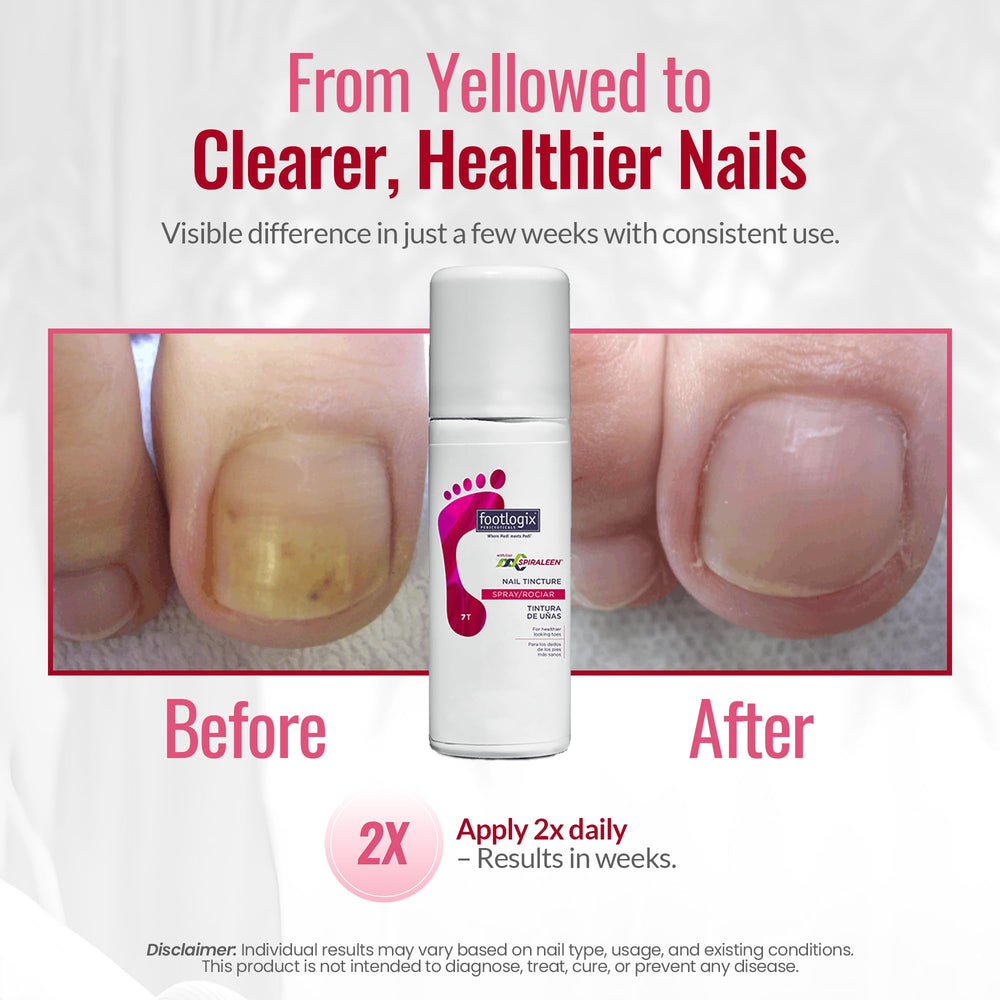 Footlogix Avocado Oil Panthenol nourishes nails for a smooth, resilient appearance.