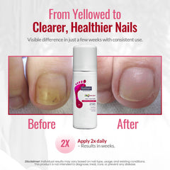 Footlogix Avocado Oil Panthenol nourishes nails for a smooth, resilient appearance.