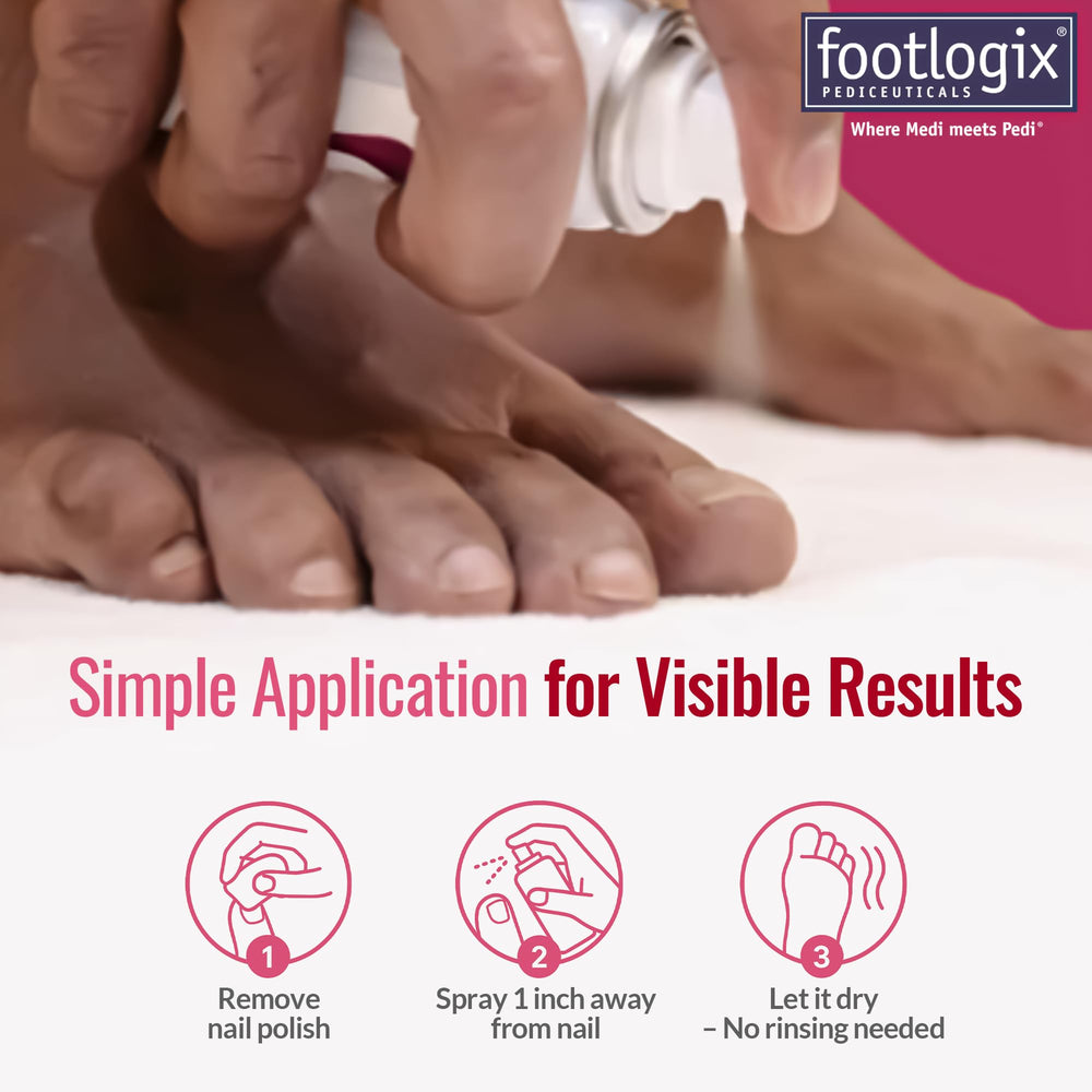 Footlogix before and after toenail care shows visible improvement.