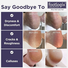 Footlogix double-sided foot file with rubberized handle for efficient callus removal