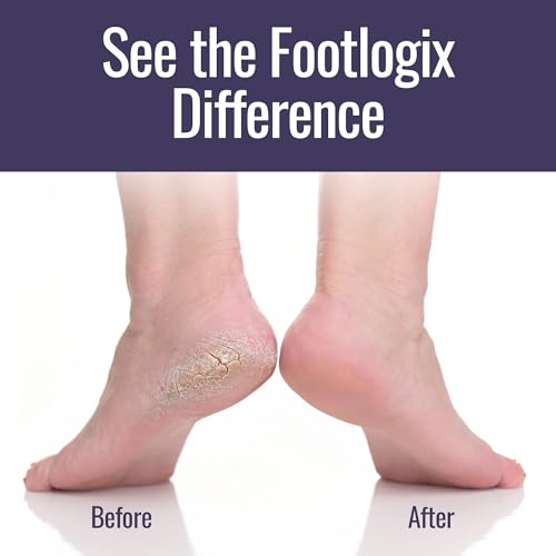 Footlogix Dry Cracked Heel closeup highlights care for tough skin.