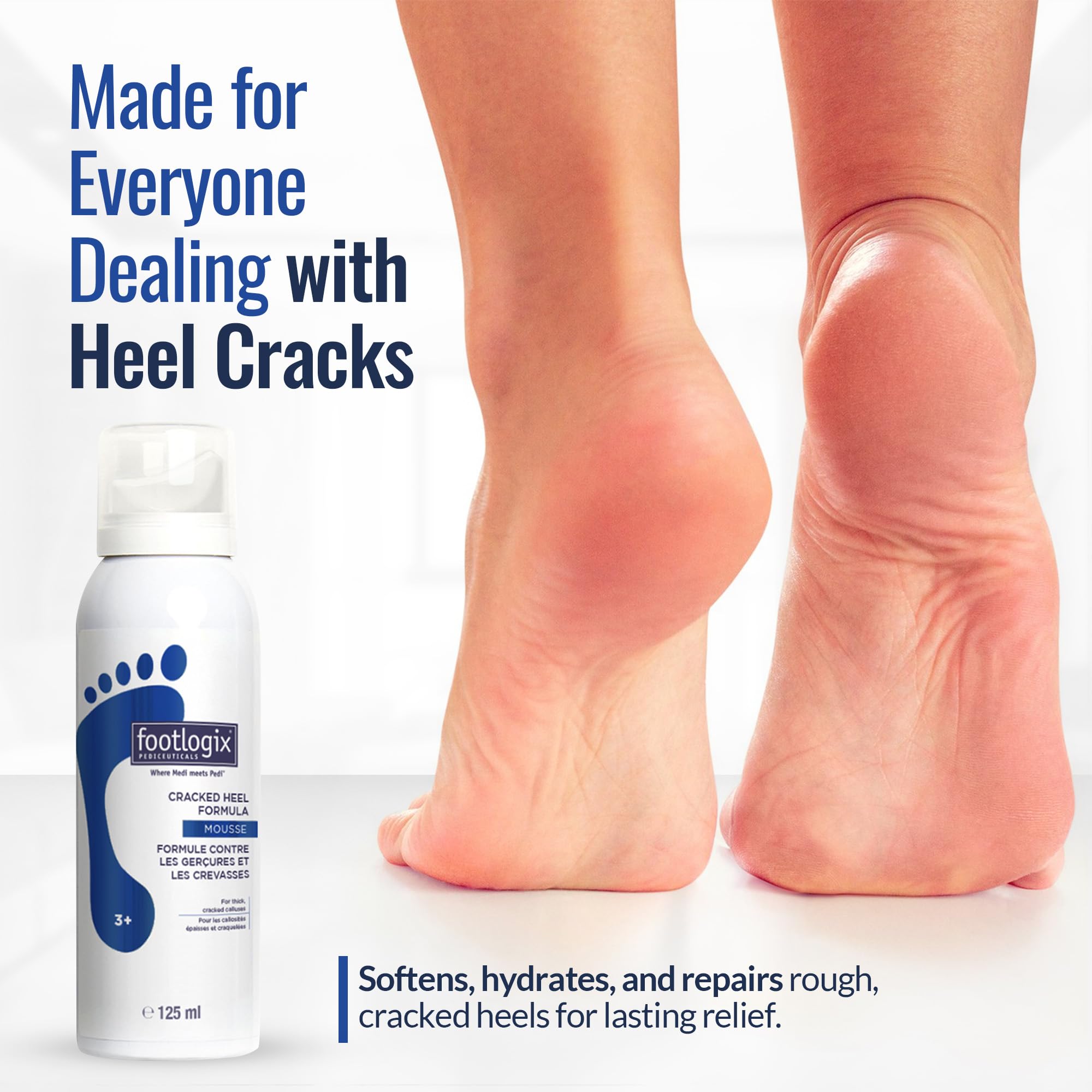 Footlogix solution for extremely dry skin on thick calluses and fissures.