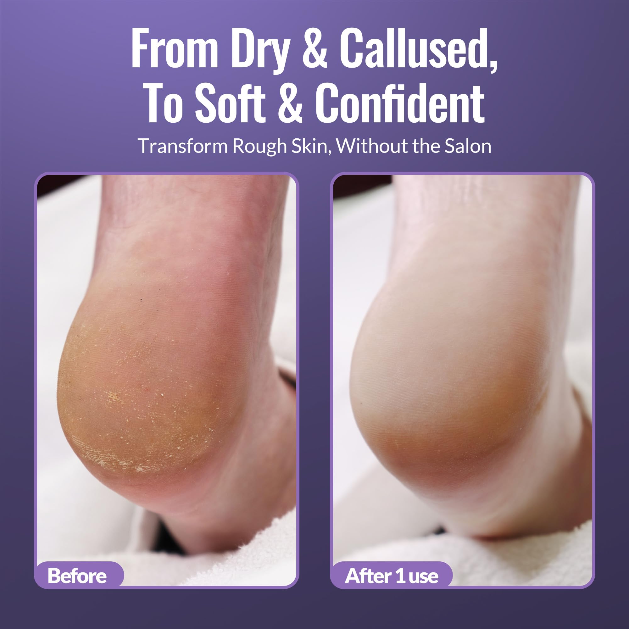 Footlogix Pedicure Kit Setup illustrates all-in-one foot care solution.