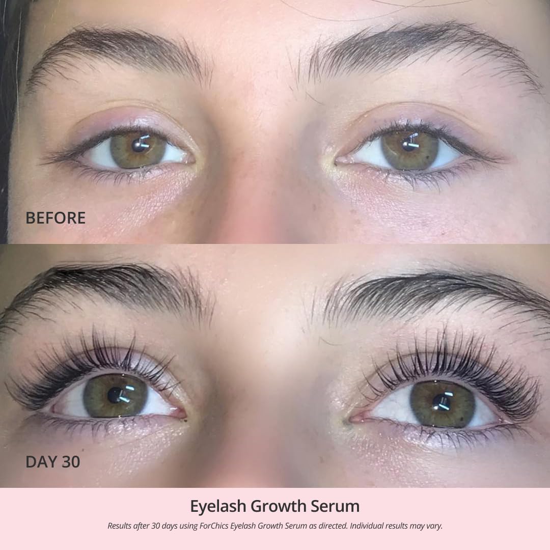 ForChics bottle illustrating potential two-week results for lashes.
