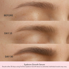 ForChics Eyebrow Growth Serum applicator fine-tip for precise nightly use.