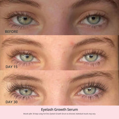 ForChics eyelash serum applicator delivering precise lash line application.
