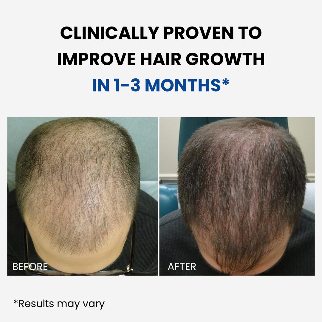 ForHair quick-absorption mist demonstrates fast-drying formula for effortless daily use.