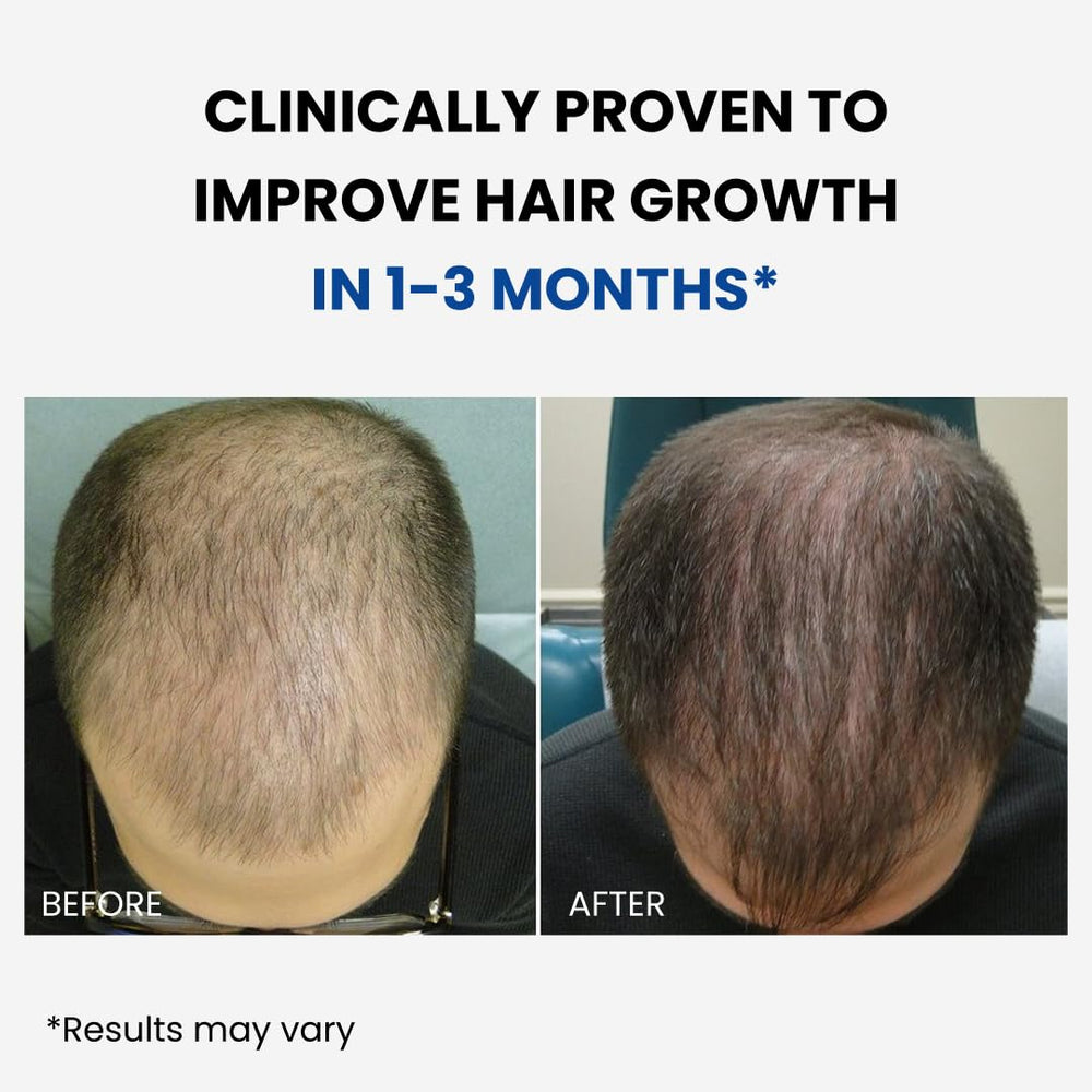 ForHair quick-absorption mist demonstrates fast-drying formula for effortless daily use.