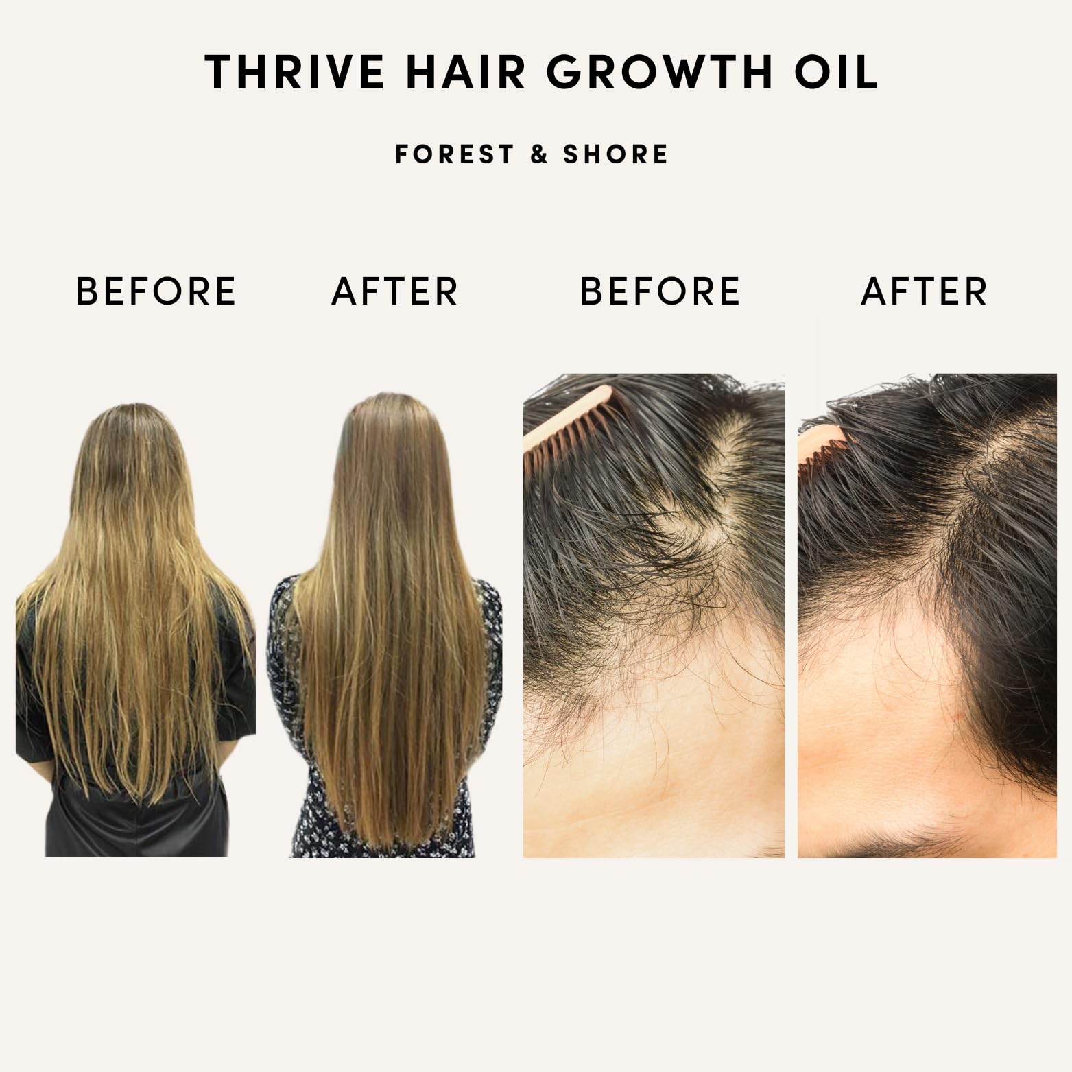 Forest & Shore dropper applying oil to scalp for nourishment and growth potential