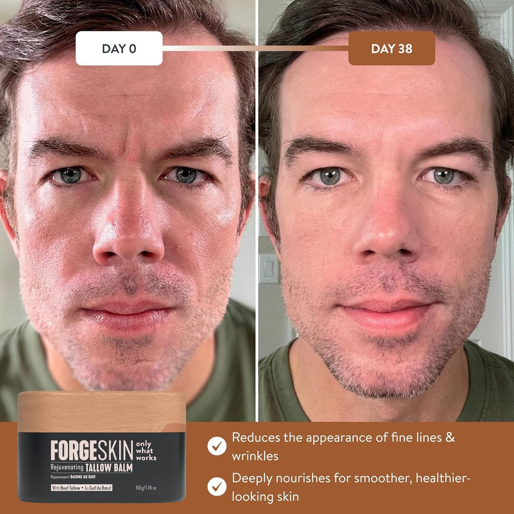 Under-eye area treated with Forge Skin Wrinkle Defense Balm for refreshed look