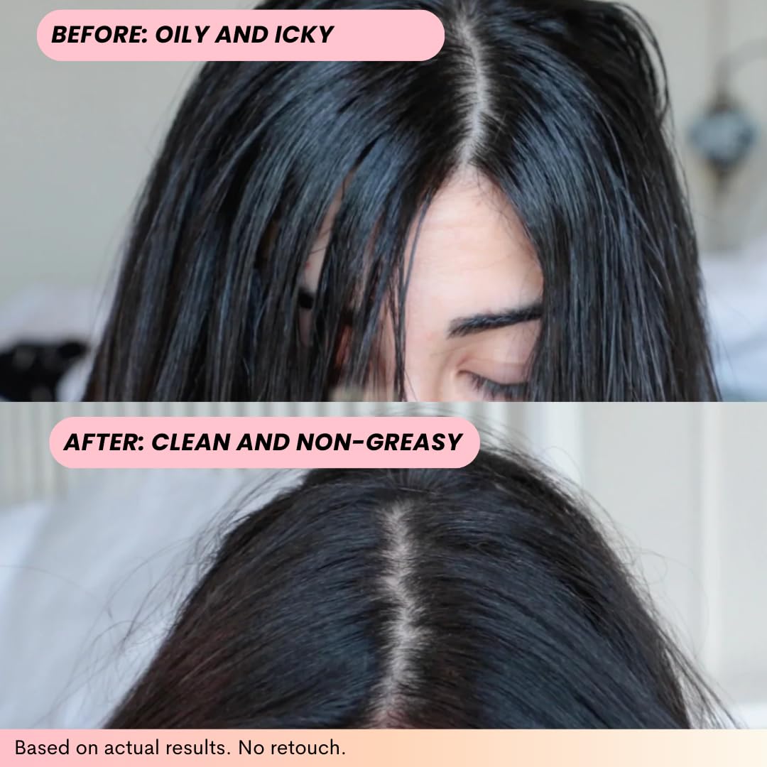 FoxyBae Champú Seco: control de grasa sin enjuague y residuo.