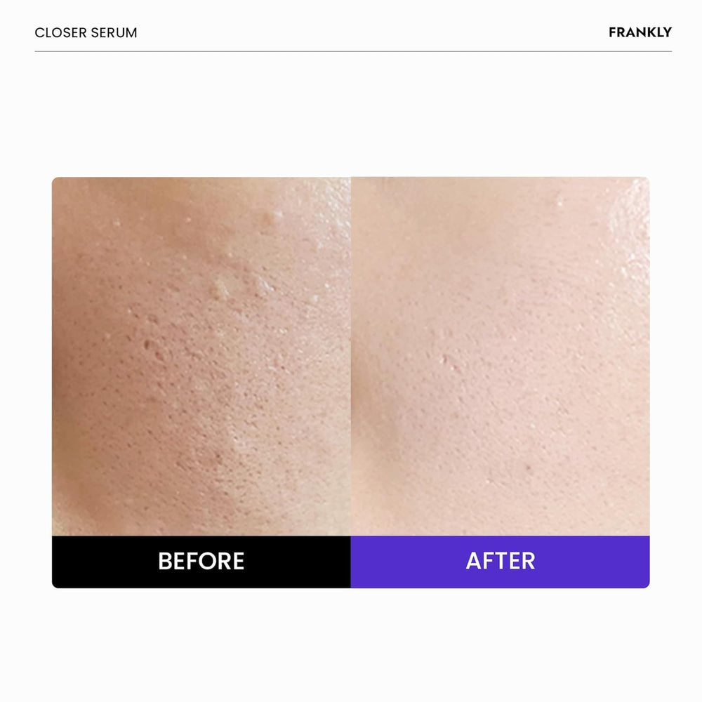 FRANKLY Closer Serum: textura cremosa que se desliza suavemente