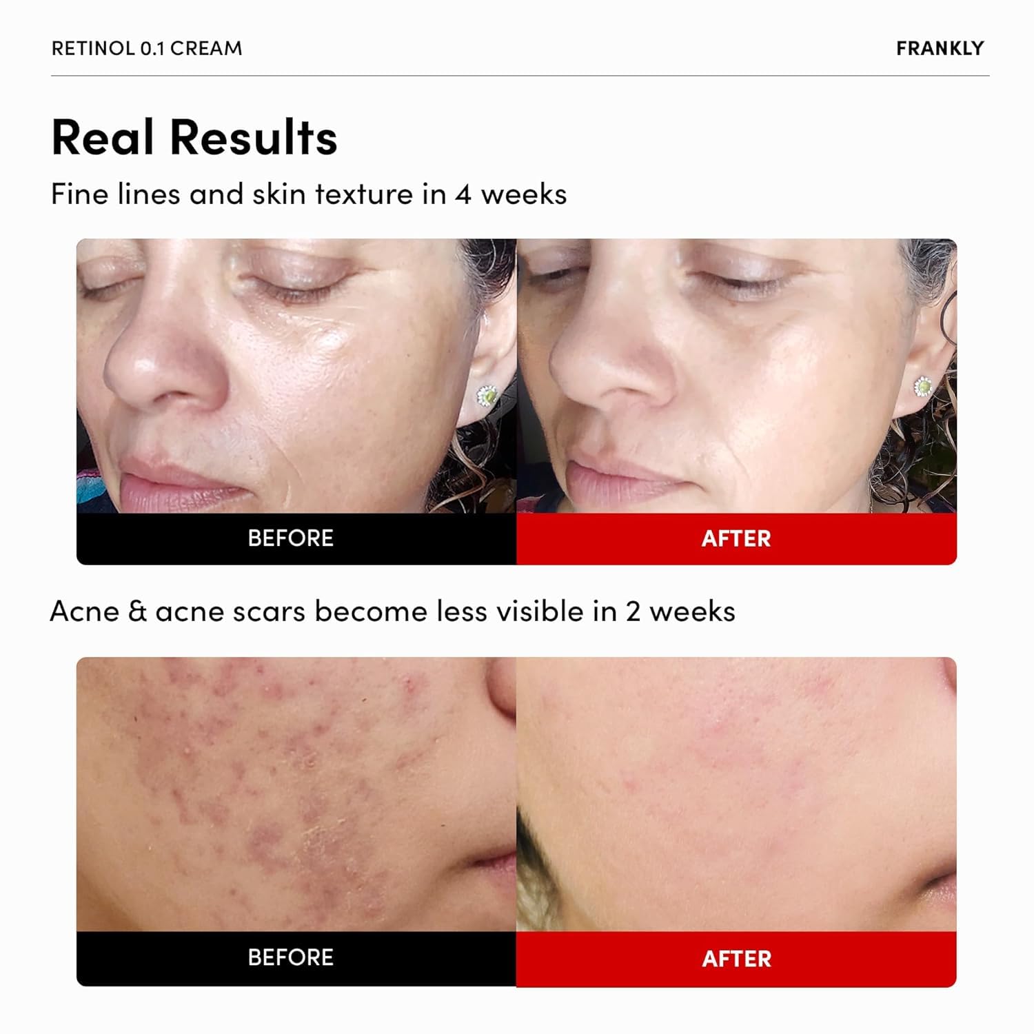 FRANKLY Retinol 0.3% Cream en bote de 0.7 oz para rutina nocturna.