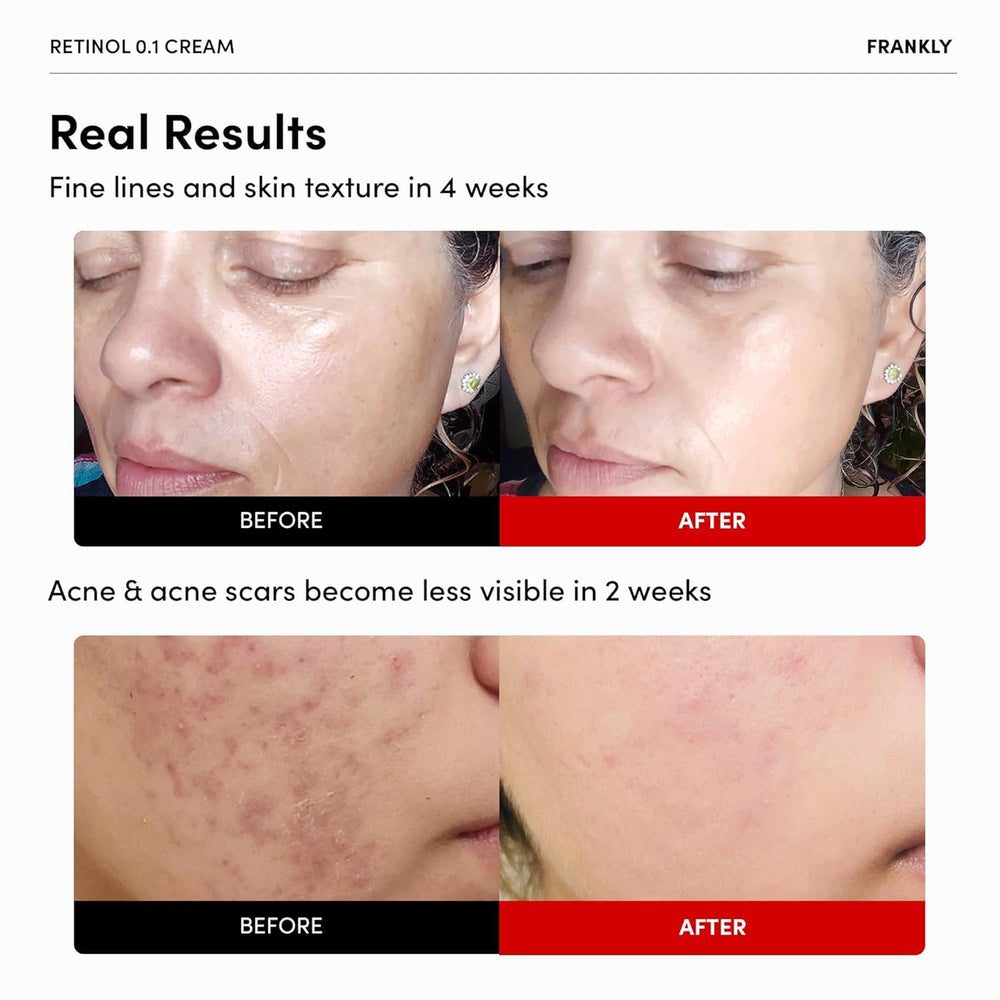 FRANKLY Retinol 0.3% Cream en bote de 0.7 oz para rutina nocturna.