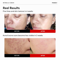 FRANKLY Retinol 0.3% Cream en bote de 0.7 oz para rutina nocturna.