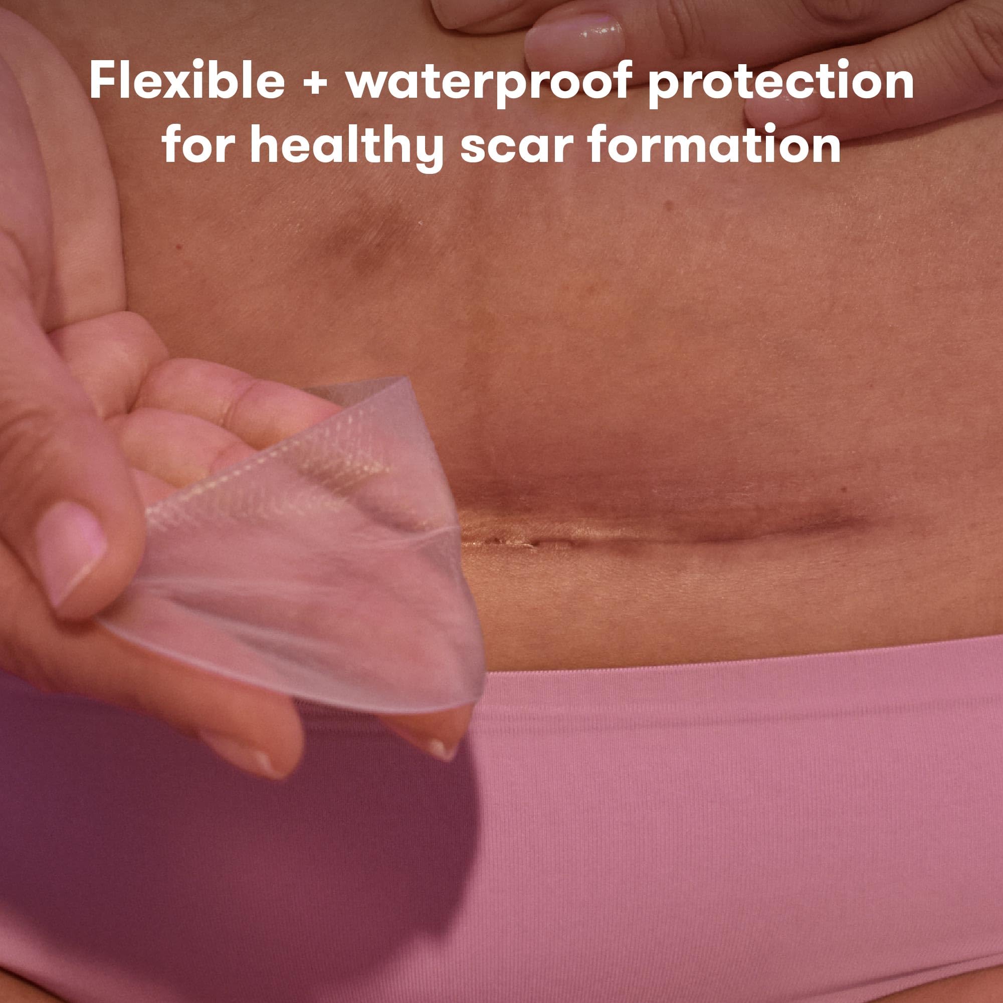 Frida Mom C-Section silicone strips on incision for hydration and protection.