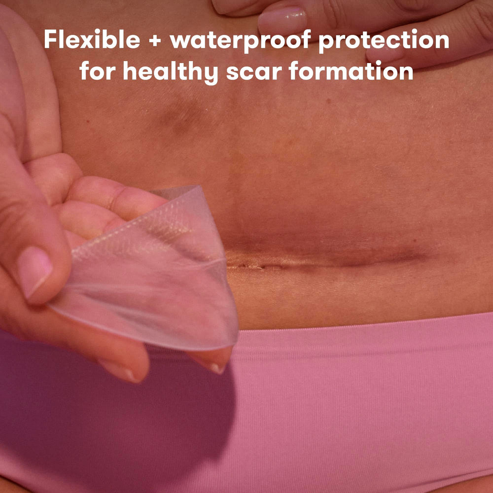 Frida Mom C-Section silicone strips on incision for hydration and protection.