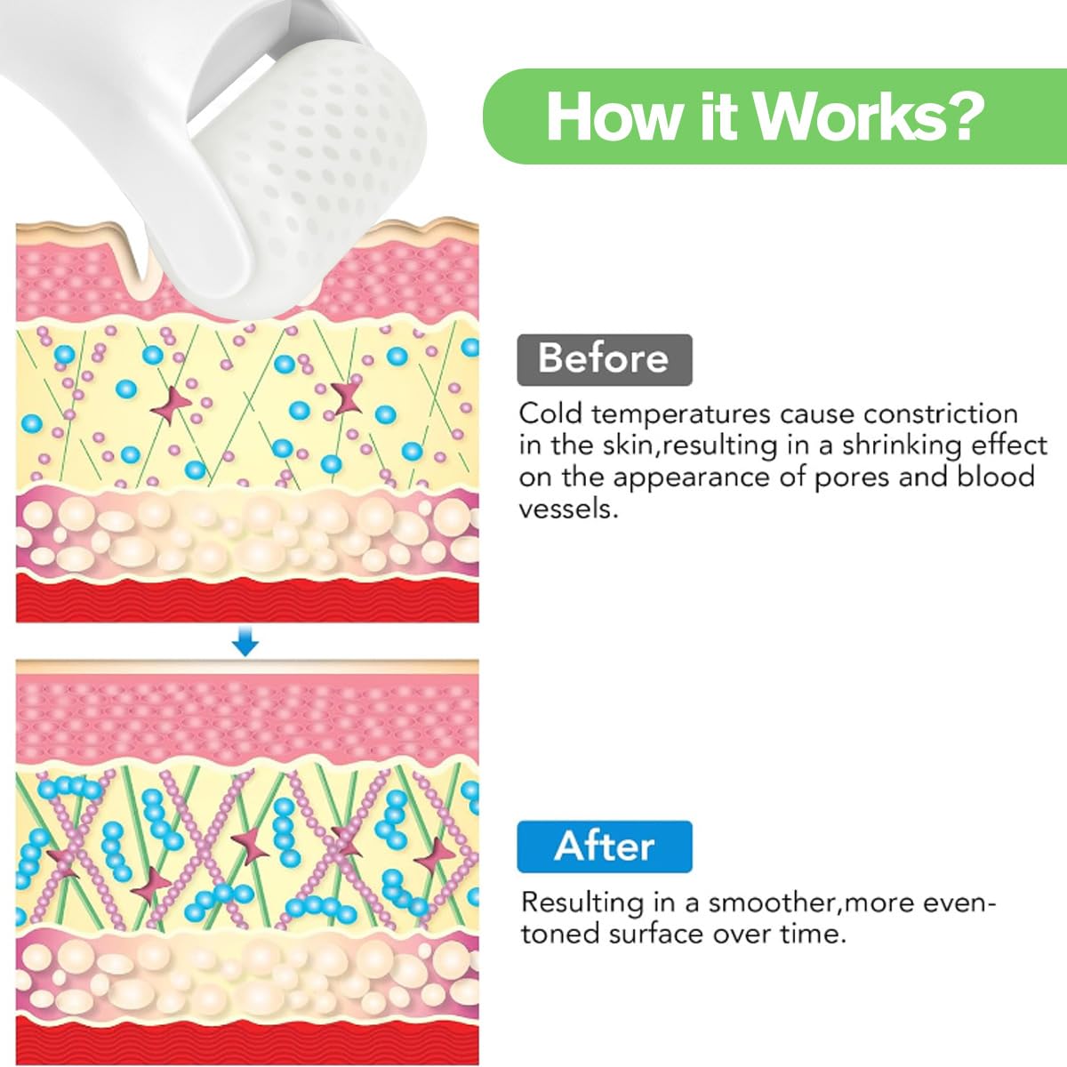 Fronnor Ice Roller jawline; provides a cooling contour and relief.