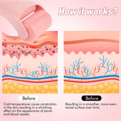 Fronnor Ice Roller under-eye helps ease fatigue and brighten the under-eye area.
