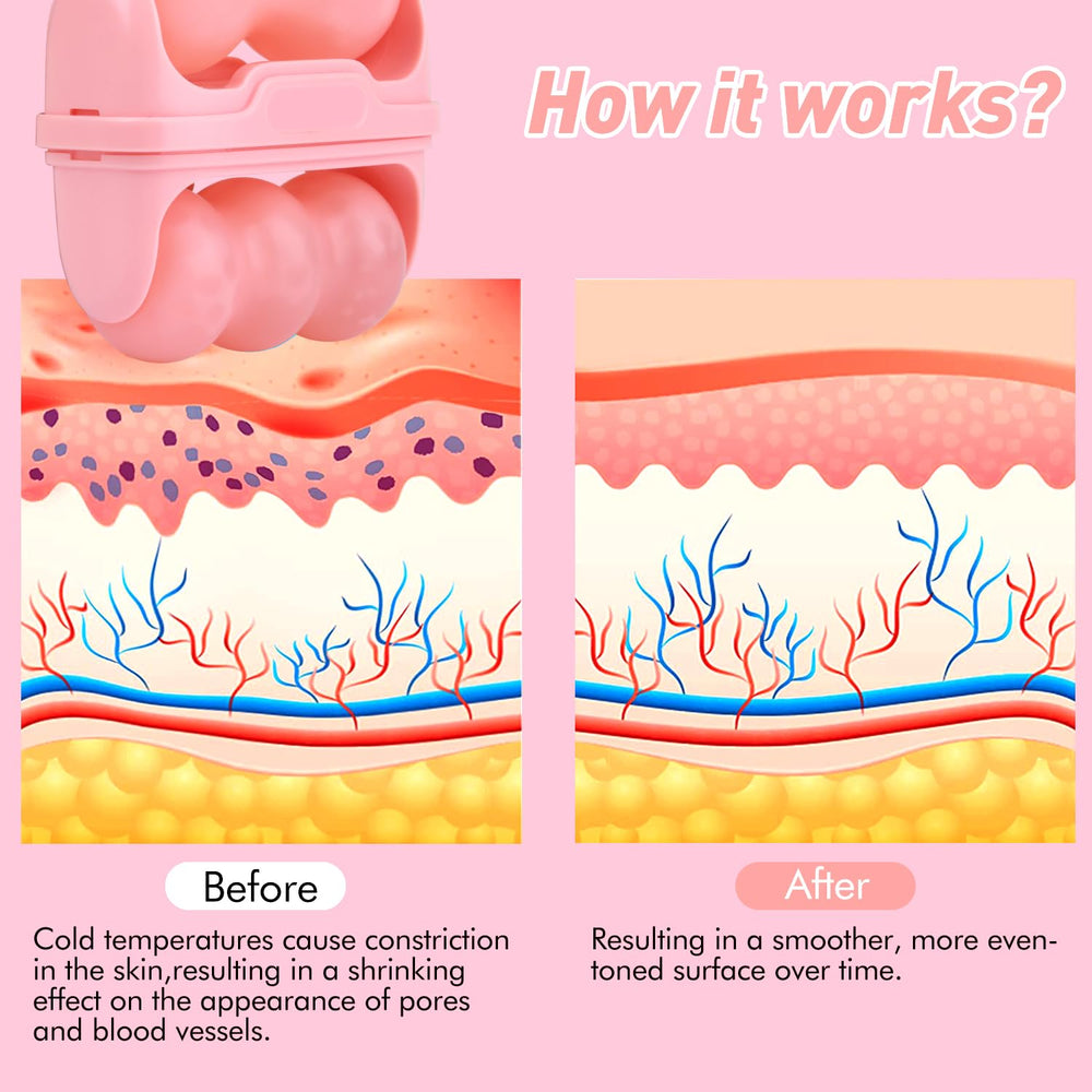 Fronnor Ice Roller used with moisturizer to aid absorption
