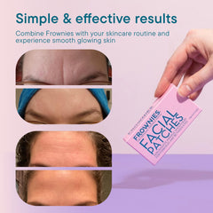 Frownies overnight-wear patches offering a simple hands-off skincare routine.