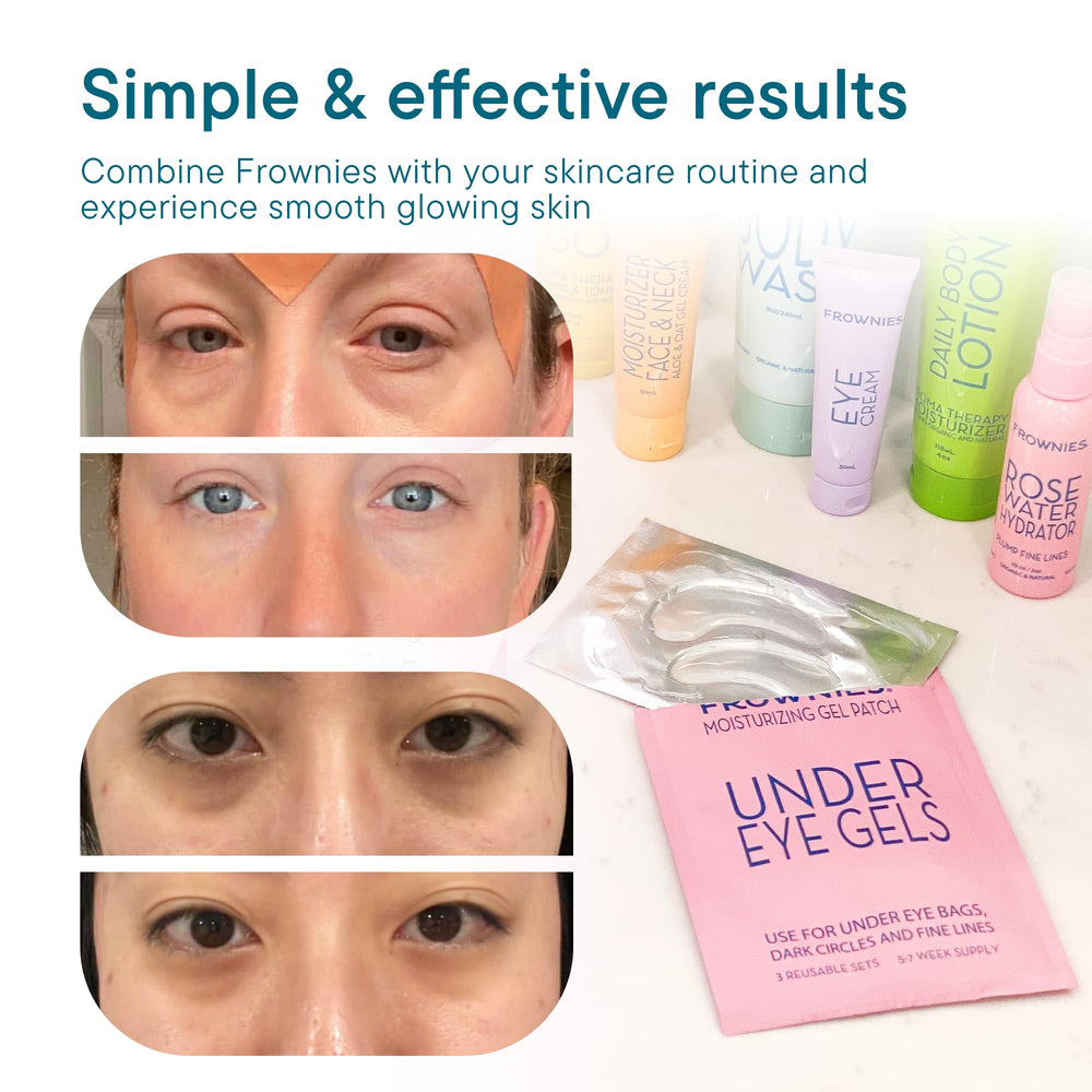 Frownies rose water hydrator spray refreshes patches for reuse.