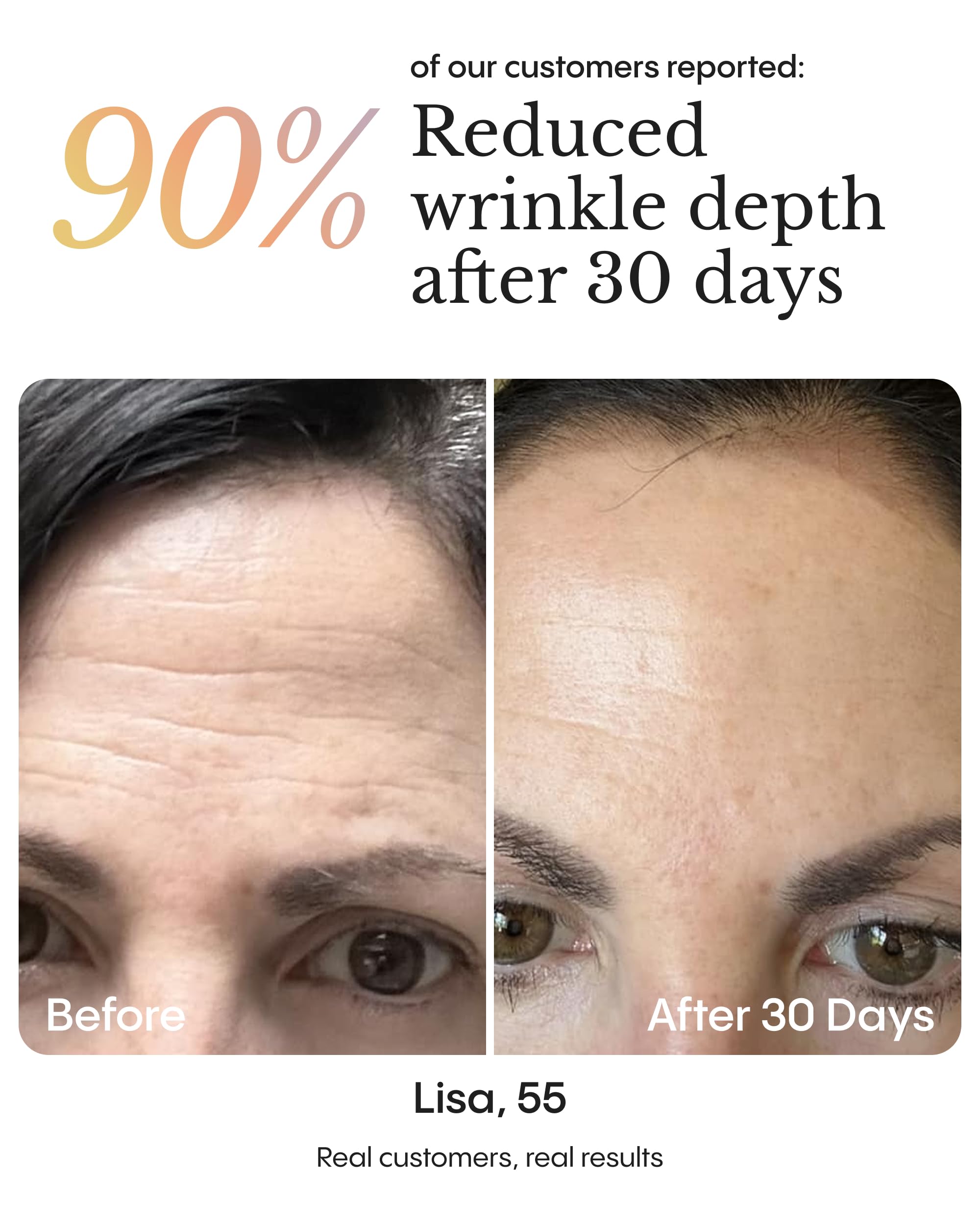 Froya Organics night balm applied on clean skin; ideal for nighttime skincare