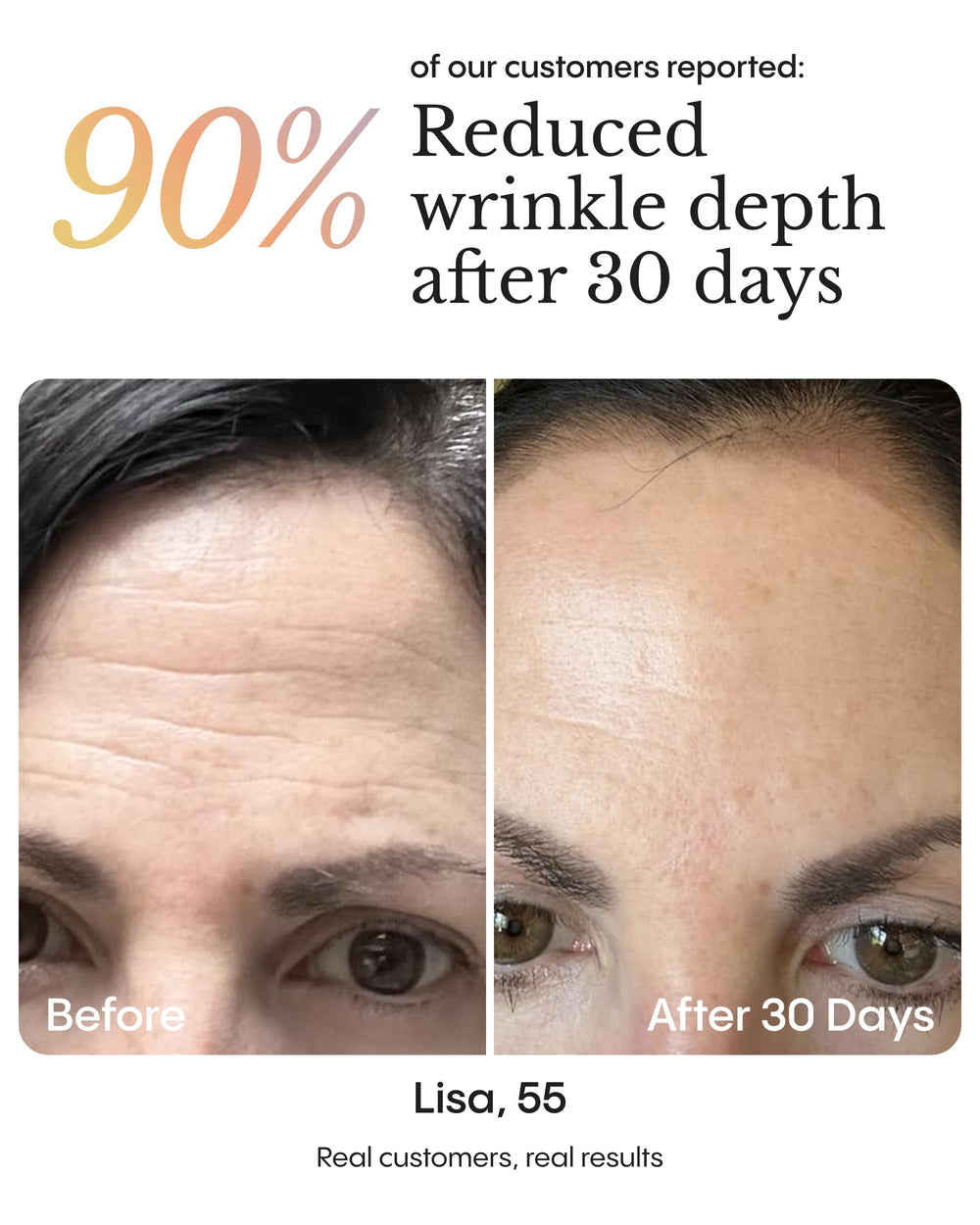 Froya Organics night balm applied on clean skin; ideal for nighttime skincare