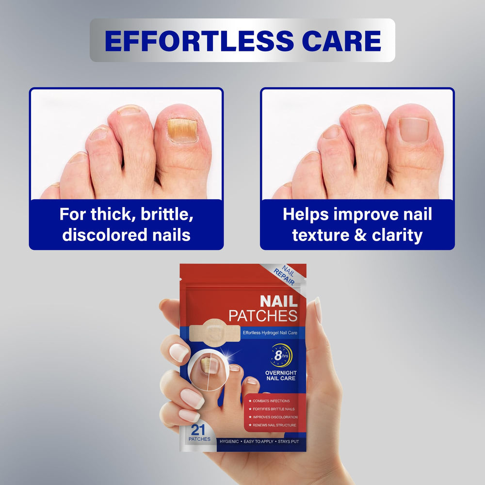Fungal Nail Patches 84-patches value-pack offers extended care for nails.