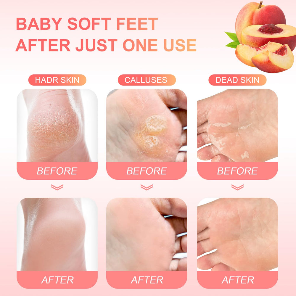 FUNNIR mascarilla exfoliante para pies, talones más suaves tras el tratamiento.