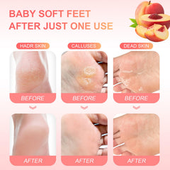 FUNNIR mascarilla exfoliante para pies, talones más suaves tras el tratamiento.