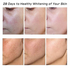 fupah crema manchas melasma ilumina sutilmente la piel