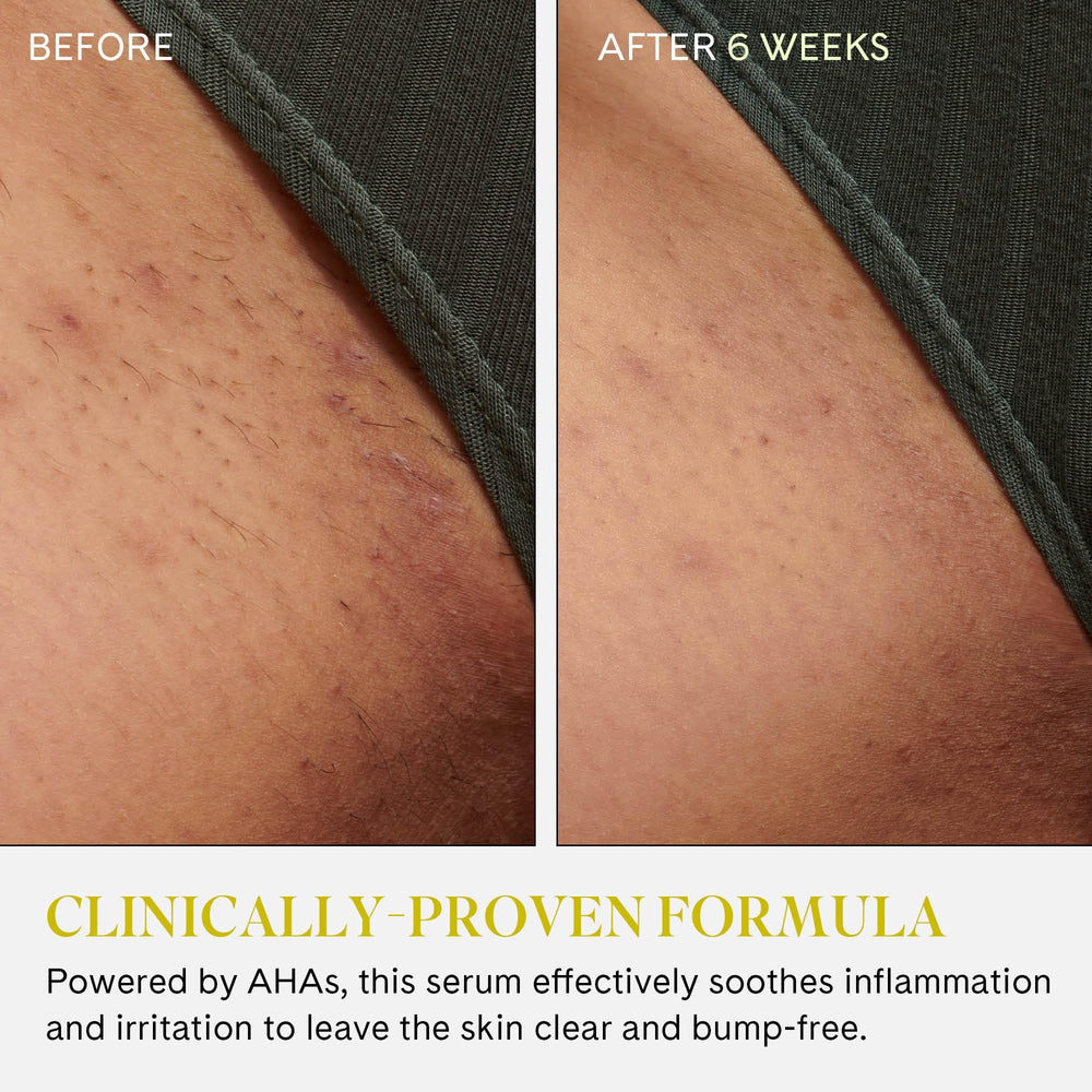 Fur Ingrown Eliminator Serum Rollerball ayuda a hidratar y calmar irritaciones.