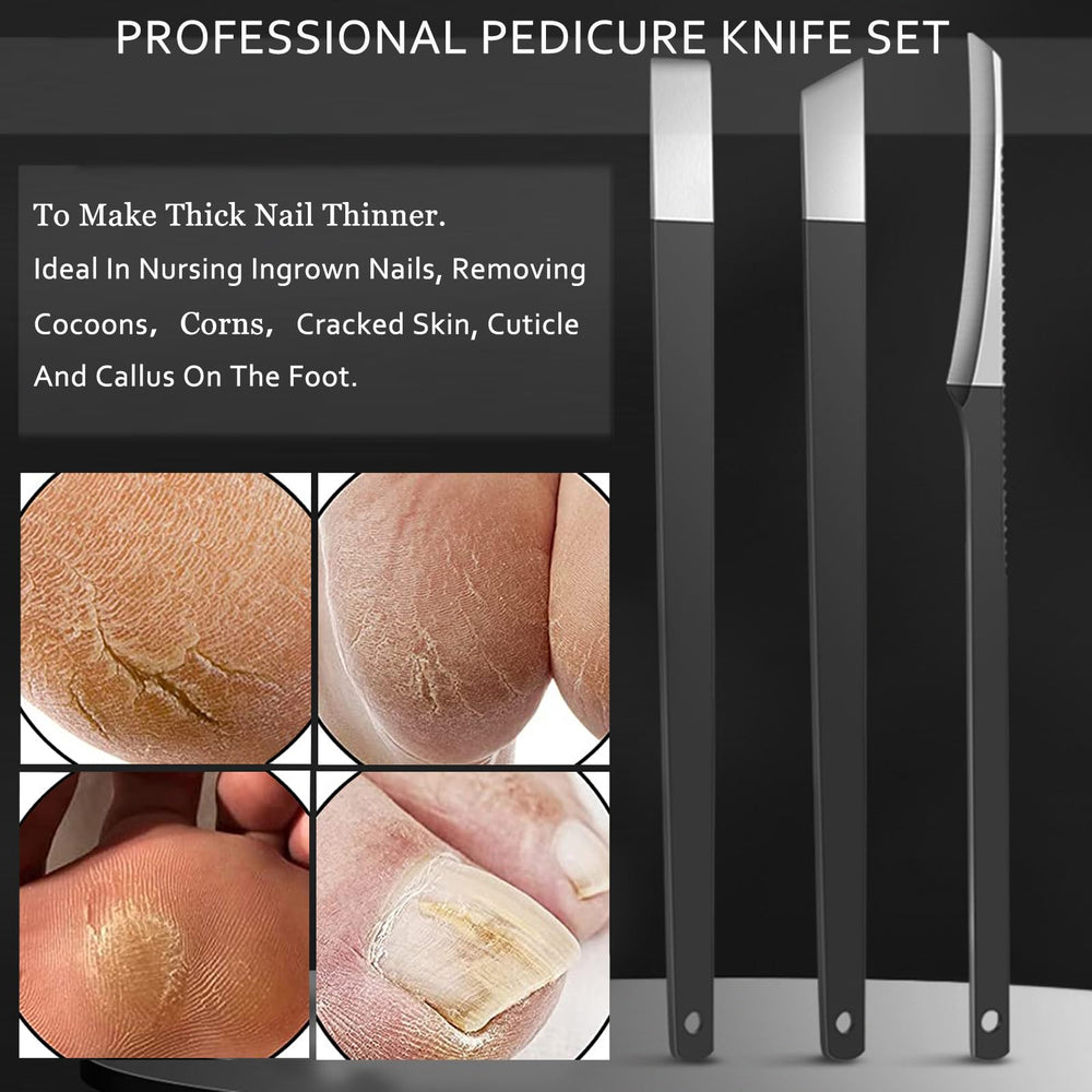 Fuwddy dead skin fork tool removing dead skin safely.