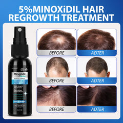 FUZYAT Minoxidil para crecimiento de cabello, con biotina e niacinamida.