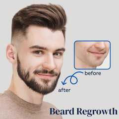 Twice-daily routine with FUZYAT Minoxidil spray supports consistent use