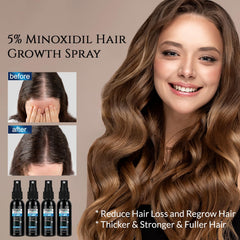 Unscented formulation of FUZYAT Minoxidil spray for sensitive users