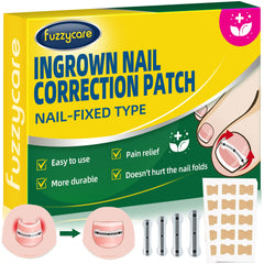 Fuzzycare titanium ingrown toenail kit box shown for home use and convenience