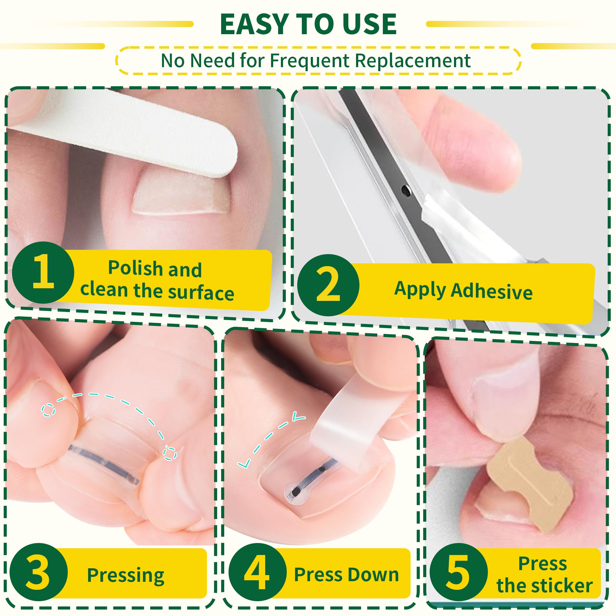 Fuzzycare various sizes patch set fits different toenail widths