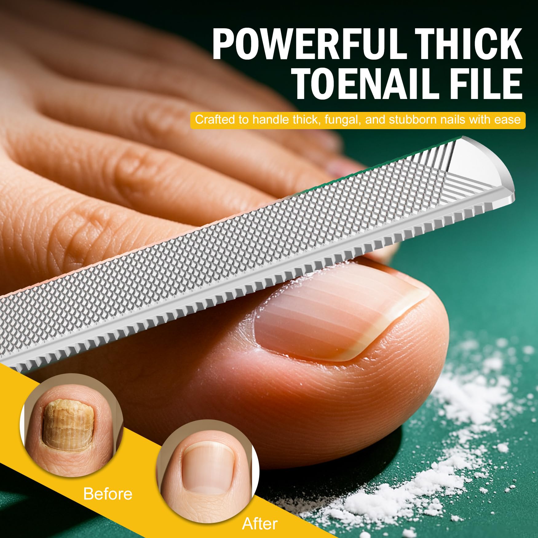 FVION ingrown-relief lifter gently lifts nails for comfortable home care