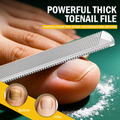 FVION ingrown-relief lifter gently lifts nails for comfortable home care