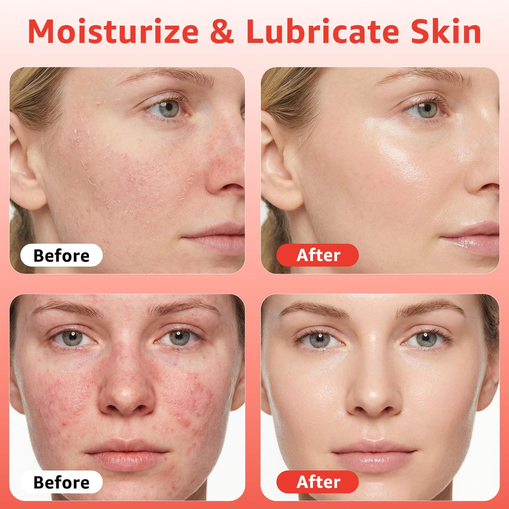 Fymiox serum luz roja: gotero para aplicación suave y precisa.